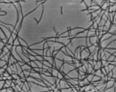 The bacteria will grow long like a long filament formation