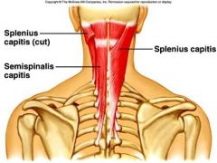 Deep Back Muscles
Semispinalis capitis