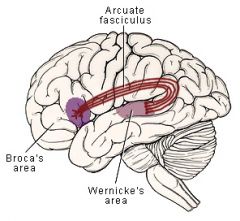 - disturbance in all areas of language function (comprehension, speaking, reading, fluency)
- often associated with right hemiparesis