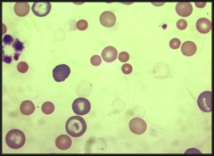 What is present on this blood smear?