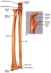Articulates with the capitulum of humerus