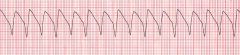 The patient remains pulseless, but now has the following rhythm:What is your next intervention?


