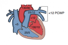 -PCWP is a good approximation of LA pressure


-in mitral stenosis PCWP > LV diastolic pressure


-pressures are measured with a pulmonary artery catheter (Swanz-Ganz catheter)