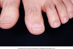 What do they toe nails tell you?