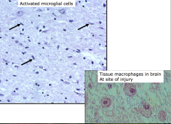 Activated Microglial cells