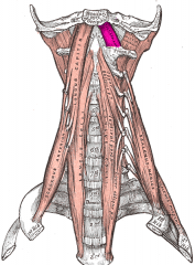 Rectus Capitis (anterior)