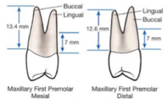 buccal and palatal root.

CEJ