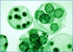 Phylum Chlorophyta   (Green Algae) 
