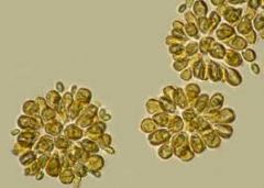 



Phylum Chrysophyta  
Diatoms 
Golden-Brown Algae  