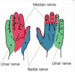 Radial – 1st webspace (dorsal)
Median – Index (palmar)
Ulnar – Little (palmar)