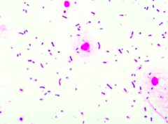 Purple cocci in pairs and short chains: Strep pneumo