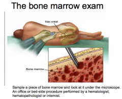 Bone marrow exam!