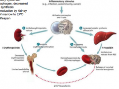 increased inflammatory cytokines lead to: 
1. trapping of iron in macrophages, decreased availability for RBC synthesis 
2. decreases EPO production by the kidney 
3. blunt response of marrow to EPO 
4. shortens RBC lifespan