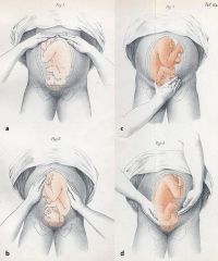 The maneuvers consist of four distinct actions, each helping to determine the position of the fetus