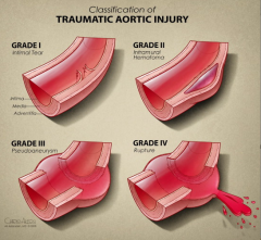 Traumatic aortic injury