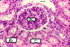 (This is an image of a Renal Corpuscle in a Nephron)