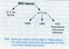 LBBB/RBBB


Intraventricular conduction delays


WPW