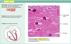 Cardiac Muscle

Cardiac muscle tissue occurs ONLY IN THE HEART, where it constitutes the bulk of the heart walls.
Like skeletal muscle cells, cardiac muscle cells are STRIATED, but cardiac muscle is not voluntary. Indeed, it can and does contract witho