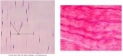 Collagenous - big straight lines (stains lighter - ligaments and tendons – no stretch, very firm) 
Elastic - thin thread like fibers (Stains pink, a little more wavy)