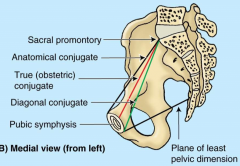 anatomical (superior pubic symphysis to promentory)
**true (obstetric) (median pubic symphysis to promentory) baby passes here
diagonal (inferior to promentory) can measure here
