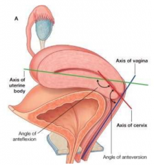 lays almost horizontal on bladder
angle between body and cervix
angle between cervix and vagina
anteflexed and anteverted position