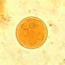 Entamoeba coli(quiste)