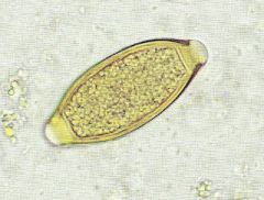 Trichuris trichiura(huevo)
