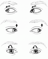 b. Brain Stem


Nystagmus is a term to describe fast, uncontrollable movements of the eyes that may be:

    Side to side (horizontal nystagmus)
    Up and down (vertical nystagmus)
    Rotary (rotary or torsional nystagmus)

Depending on...