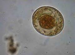Hymenolepis nana(huevo)