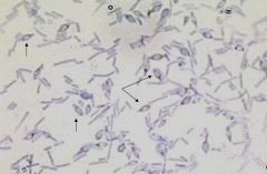 Gram positive bacilli with terminal spore