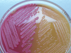 MacConkey Agar shows if a bacteria is Lactose fermenting.
The bacteria is lactose fermenting as demonstrated by the pink color