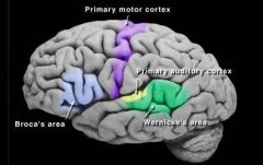 d. temporal 

Wernicke area, region of the brain that contains motor neurons involved in the comprehension of speech. This area was first described in 1874 by German neurologist Carl Wernicke. The Wernicke area is located in the posterior third ...