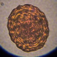 Ascaris lumbricoides(huevo)
