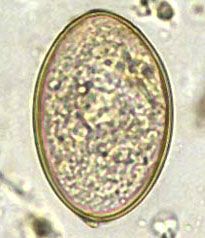 Diphyllobotrium pacificum(huevo)