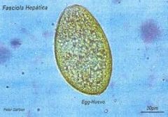 Fasciola hepática(huevo)