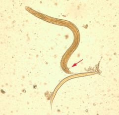 Strongyloides stercoralis(larva)