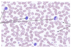 Purple Cells at Pointer