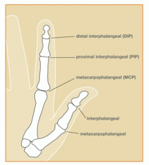 D.I.P. is distal inter-phalangeal joint.


 


P.I.P. is proximal inter-phalangeal joint.


 


M.C.P. is meta-carpo-phalangeal joint.