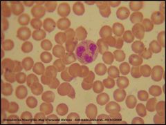 Neutrophils - because of their multilobed nucleus structure, they are termed as Polymorphonuclear leukocytes. True
