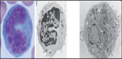  Monocytes -  Normally they are found 500 - 1,000. 
