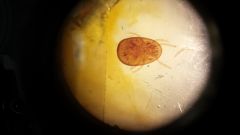Ph. Chelicerata
Cl. Arachnida
Scl. Acari
soft ticks
no scotum
head is sub terminal 
fowl tick