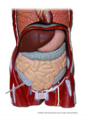 Identify the highlighted structure of the large intestine._______