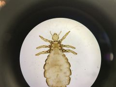 Ph. Arthropoda
Cl. Insecta
O. Phthiraptera  

sucking lice