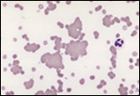 clumping in clusters; diagnosis of IMHA