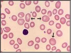 larger than normal RBC; normal in reticulocytosis in regenerative anemia