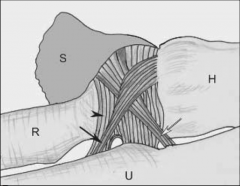Anterior & posterior margins of the sigmoid (radial) notch
