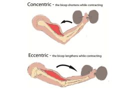 Both contraction types shown in the image below are: