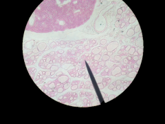 What gland is this (bottom cells)? Where is it located?