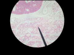 What gland is this (top cells)? Where is it located?
