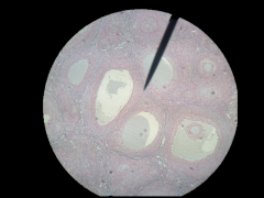 What gland is this? Where is it located?